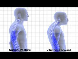 The body posture corrector