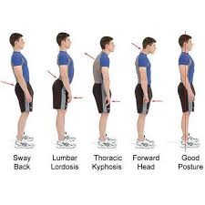 The body posture corrector